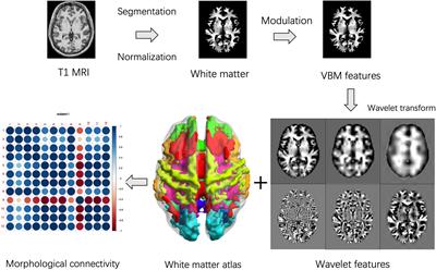 Mapping white matter structural covariance connectivity for single subject using wavelet transform with T1-weighted anatomical brain MRI